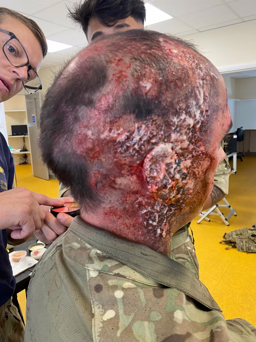 Casualty simulation burn effect applied during British Army training